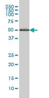 Monoclonal Mouse anti-Human HERPUD1 / HERP Antibody (clone 2G7, WB)