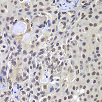 Polyclonal Rabbit anti-Human PRKDC / DNA-PKcs Antibody (IHC, WB)
