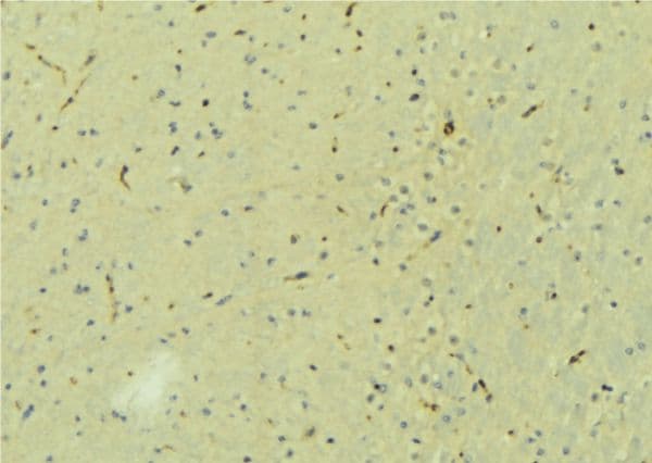 CPLX2 / Complexin 2 Antibody