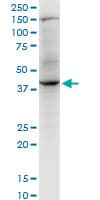 Monoclonal Mouse anti-Human RNF2 / RING2 / RING1B Antibody (clone 4A9, WB)