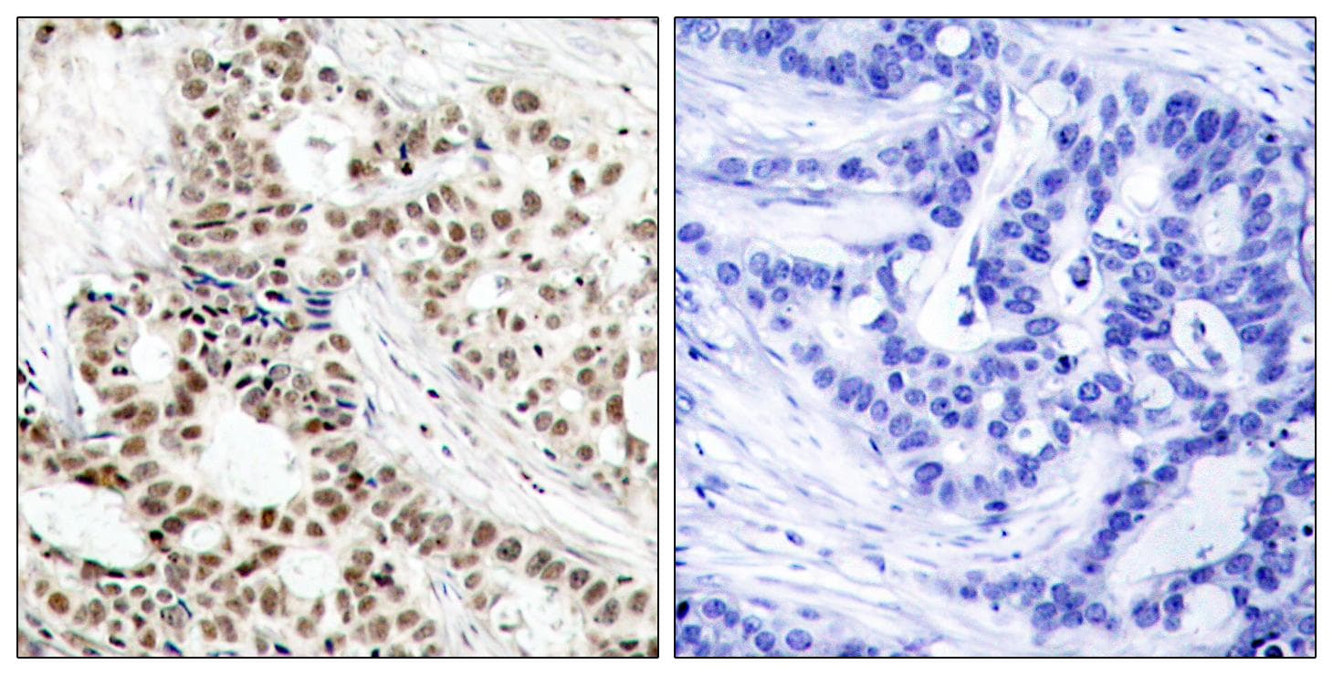 Polyclonal Rabbit anti-Human BRCA1 Antibody (phospho-Ser1423, IHC)