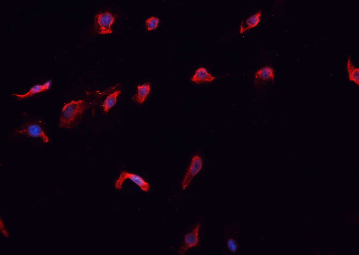 Polyclonal Rabbit anti-Human CASP10 / Caspase 10 Antibody (IHC, IF, WB)