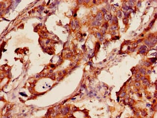 GSR / Glutathione Reductase Antibody