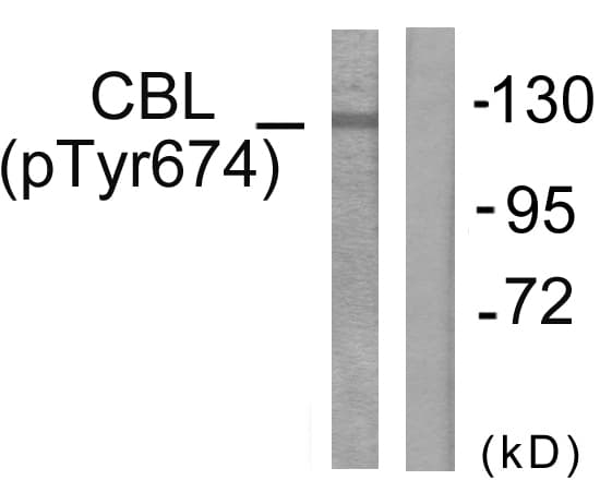 Polyclonal Rabbit anti-Human c-CBL Antibody (phospho-Tyr674, IHC, WB)