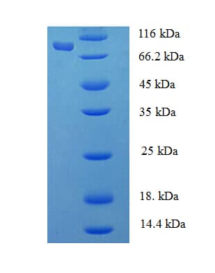 Human FARSA Protein (Recombinant His-SUMO)