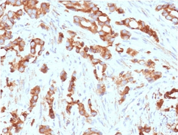 AURKB / Aurora-B Antibody (clone ARRK2-1)