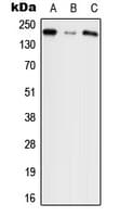 Polyclonal Rabbit anti-Human AGRN / Agrin Antibody (C-Terminus, WB)