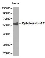 Polyclonal Rabbit anti-Human KRT17 / CK17 / Cytokeratin 17 Antibody (IHC, WB)