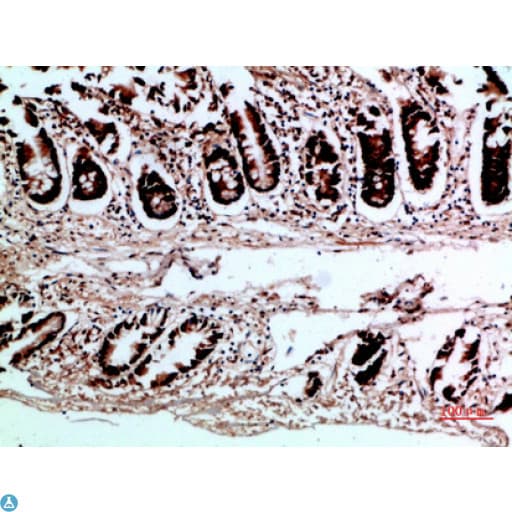 Polyclonal Rabbit anti-Human VHL / Von Hippel Lindau Antibody (IHC)