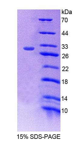 Mouse PCCB Protein (Recombinant His-T7, N-terminus)