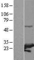 PSMC3IP Protein (Over-Expression Lysate Myc-DDK (Flag))