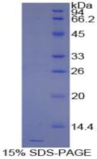 Bovine CCL5 / RANTES Protein (Recombinant His)