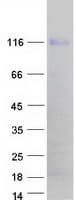 Human NFAT1 / NFATC2 Protein (Recombinant Myc-DDK (Flag))