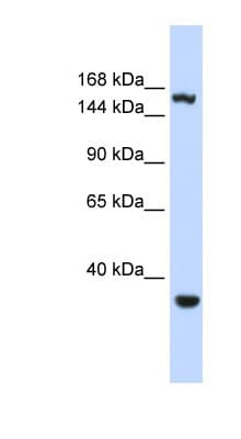 Polyclonal Rabbit anti-Human EIF4G3 Antibody (aa1152-1201, WB)