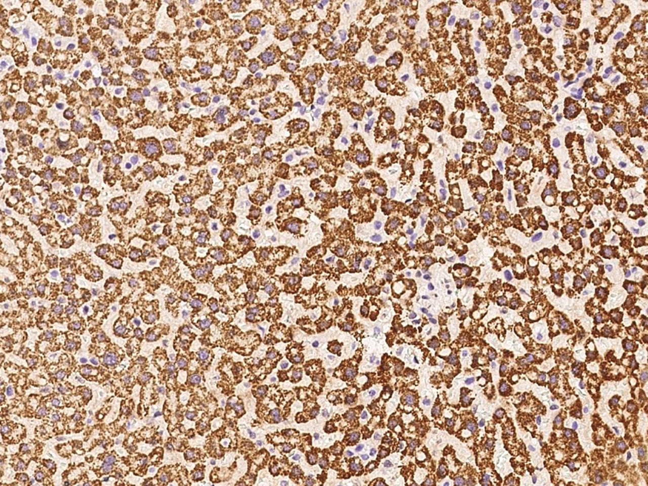 HMGCS1 / HMG-CoA Synthase 1 Antibody