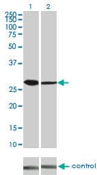 Monoclonal Mouse anti-Human CDK4 Antibody (clone 4F11, IF, WB)