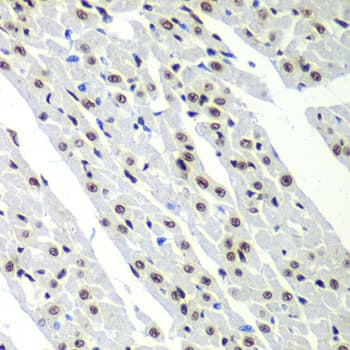 Polyclonal Rabbit anti-Human SF3B2 Antibody (IHC, IF, WB)