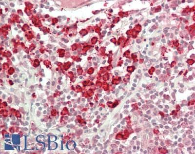 IHC-plus™ Betaglycan / TGFBR3 Antibody (aa801-850)