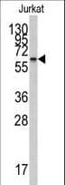 CYP26 / CYP26A1 Antibody (aa118-147)