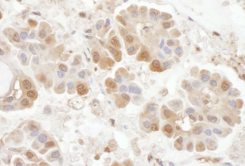 RABGEF1 Antibody (aa475-525)
