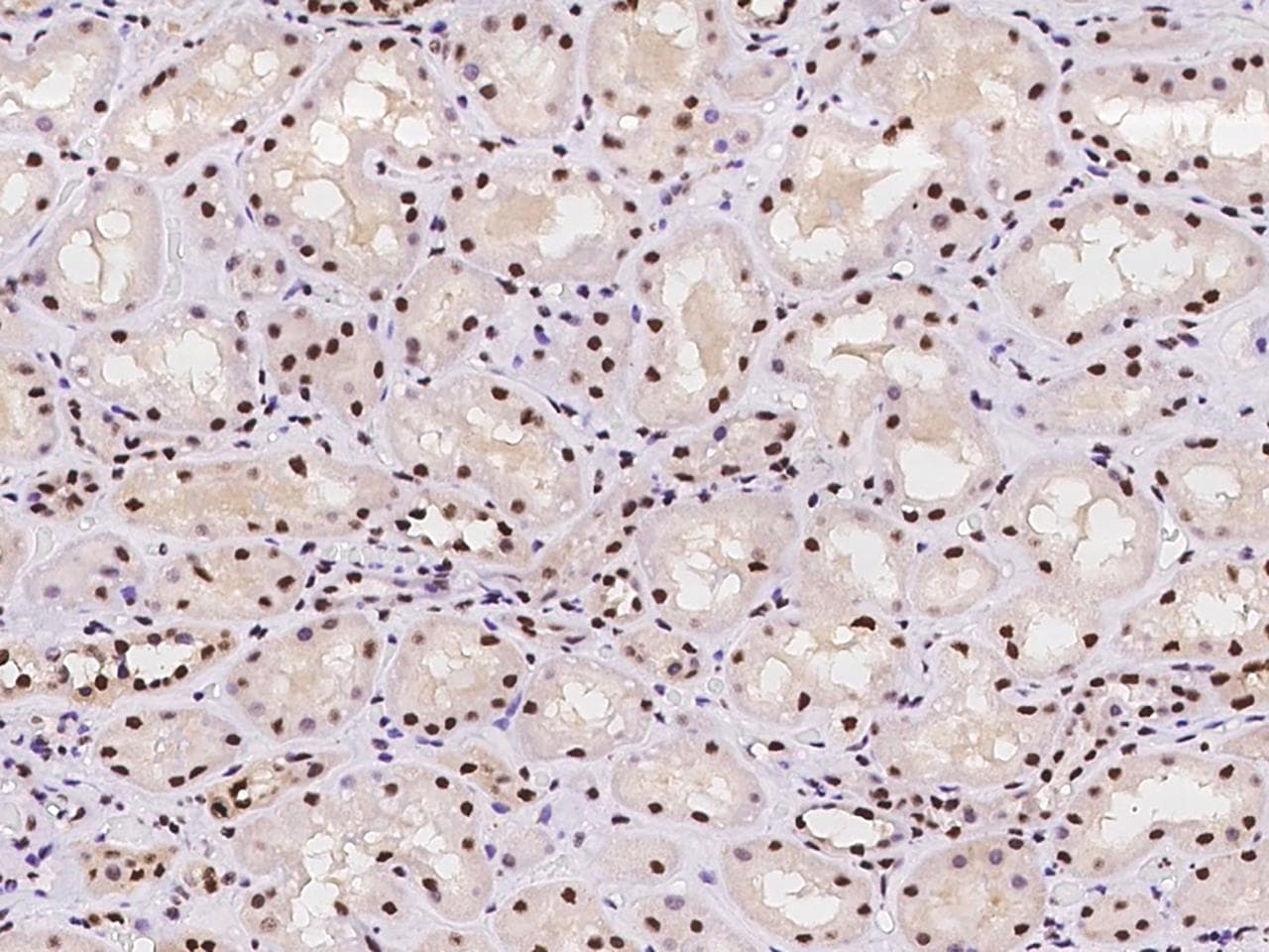 RPA3 Antibody
