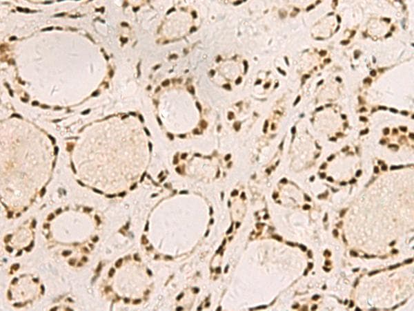 SAP30BP / HTRG Antibody