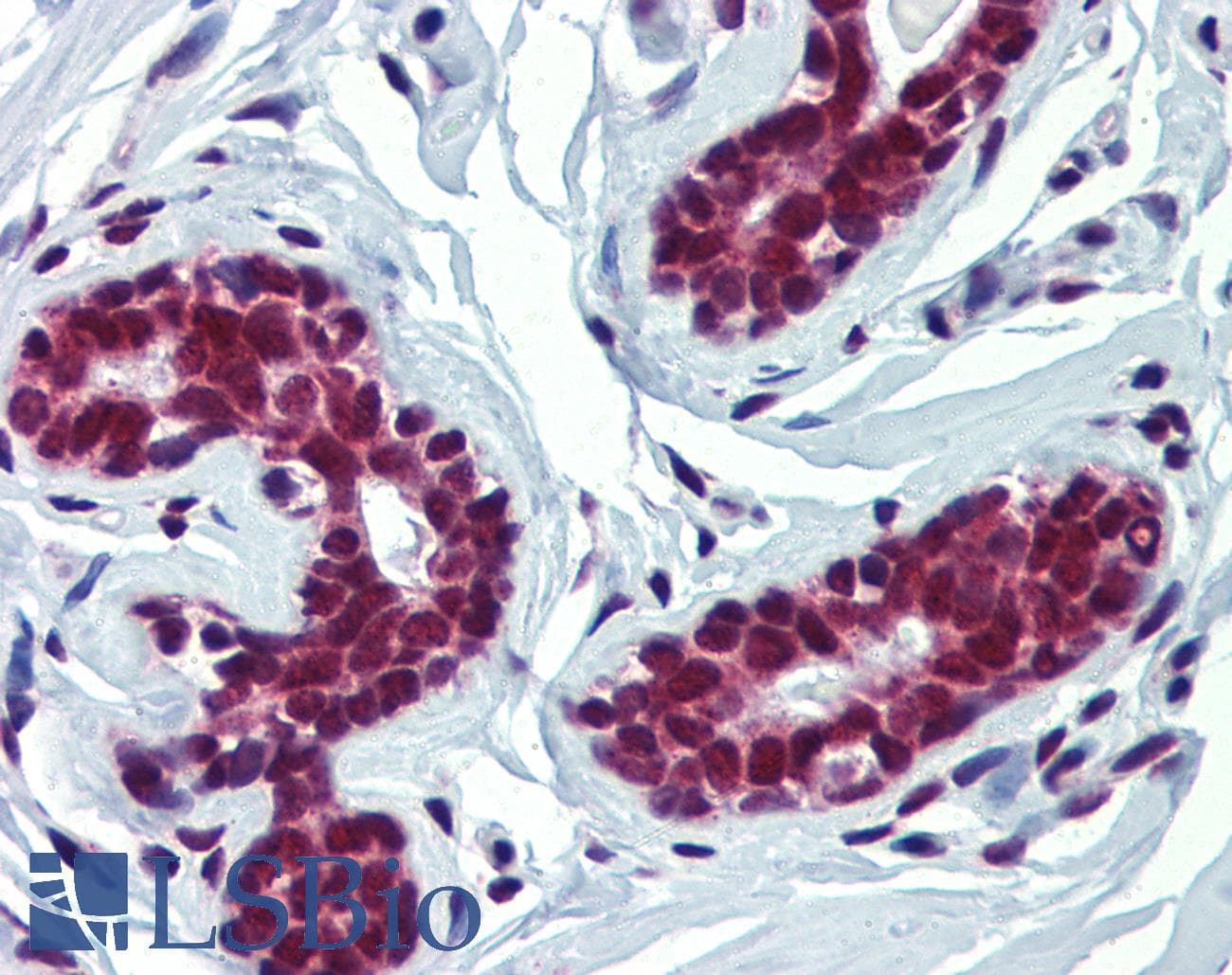 Polyclonal Rabbit anti-Human FUBP3 Antibody (aa503-552, IHC, WB)