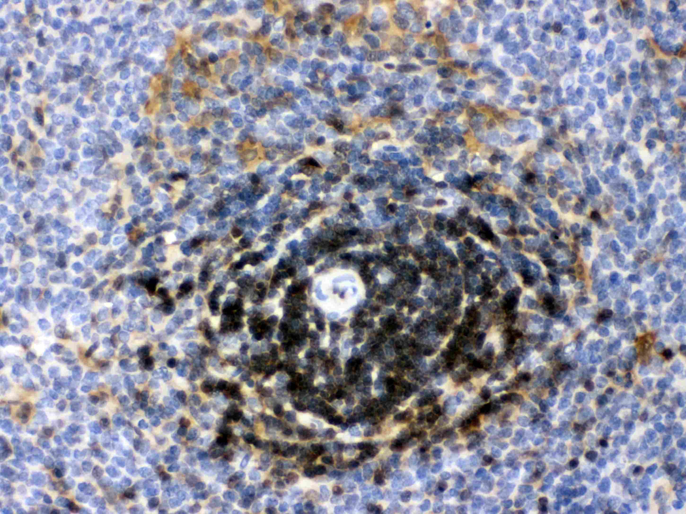 LDHB / Lactate Dehydrogenase B Antibody