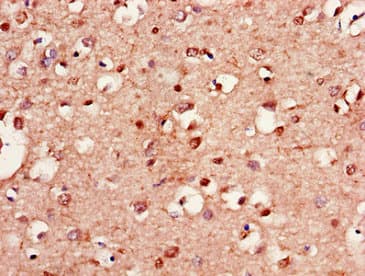 LANCL1 Antibody