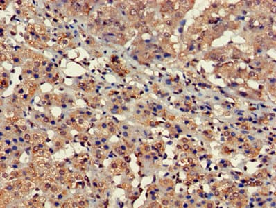 Polyclonal Rabbit anti-Human FARP2 / FRG Antibody