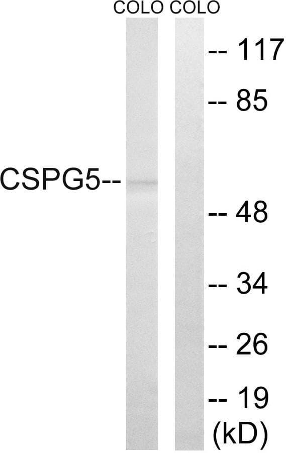 CSPG5 / Neuroglycan C Antibody