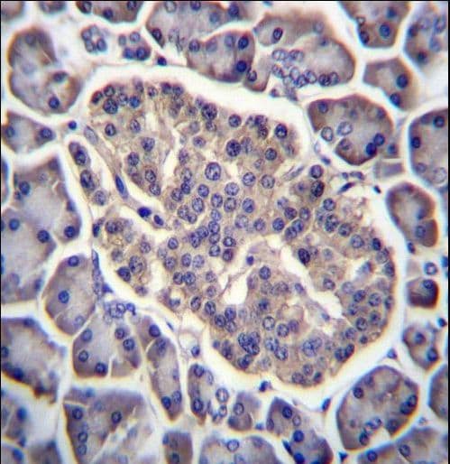 Polyclonal Rabbit anti-Human GPD2 Antibody (aa606-634, IHC, WB)