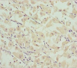 CHIC2 Antibody