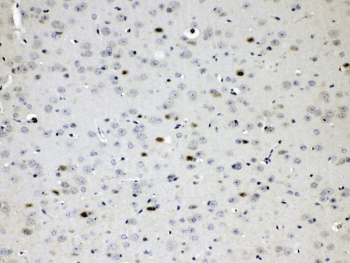 CHAT Antibody