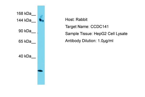CCDC141 Antibody (aa639-688)