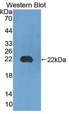 UMPS / OPRT Antibody (aa311-481)