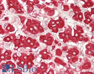 IHC-plus™ MGST1 Antibody (aa25-74)