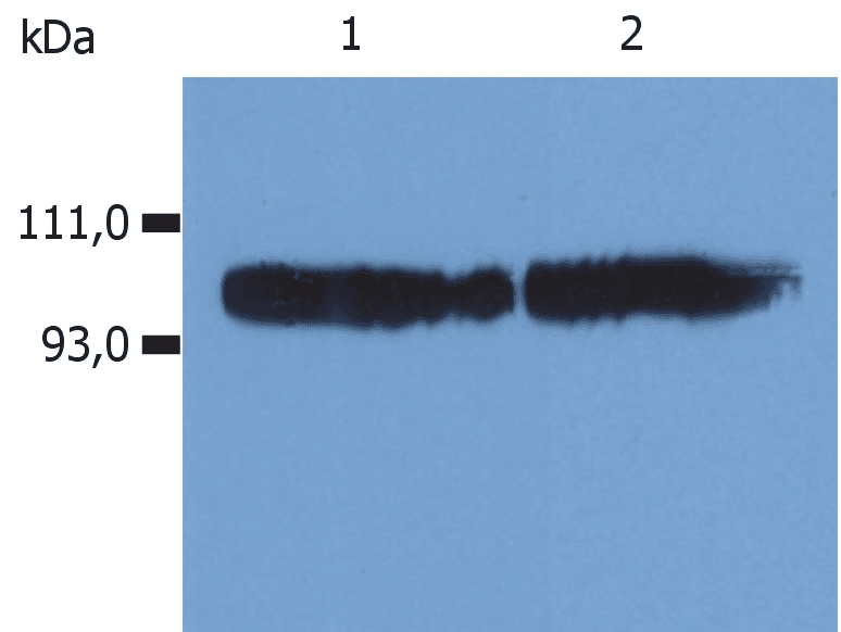 IHC-plus™ Monoclonal Mouse anti-Human ITGB2 / CD18 Antibody (clone MEM-48, IHC, WB)