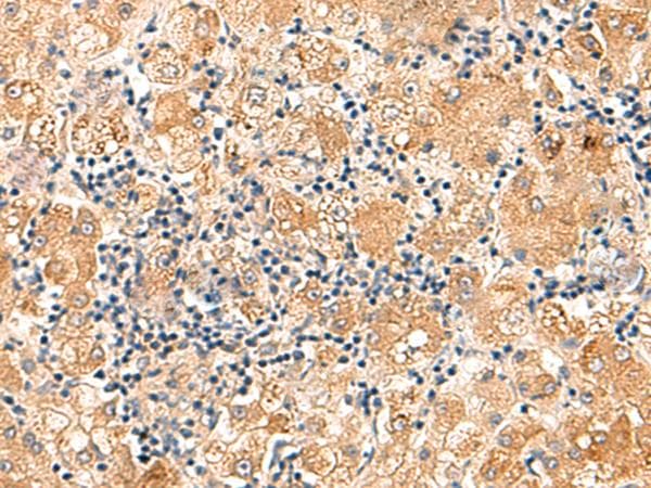 Polyclonal Rabbit anti-Human EIF3K Antibody (IHC, WB)