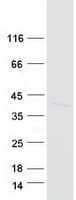Human CALHM2 Protein (Recombinant Myc-DDK (Flag))