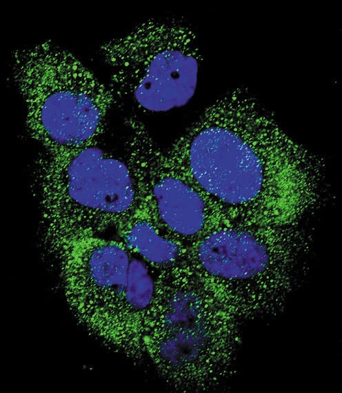 ABL1 / c-ABL Antibody (phospho-Tyr185)