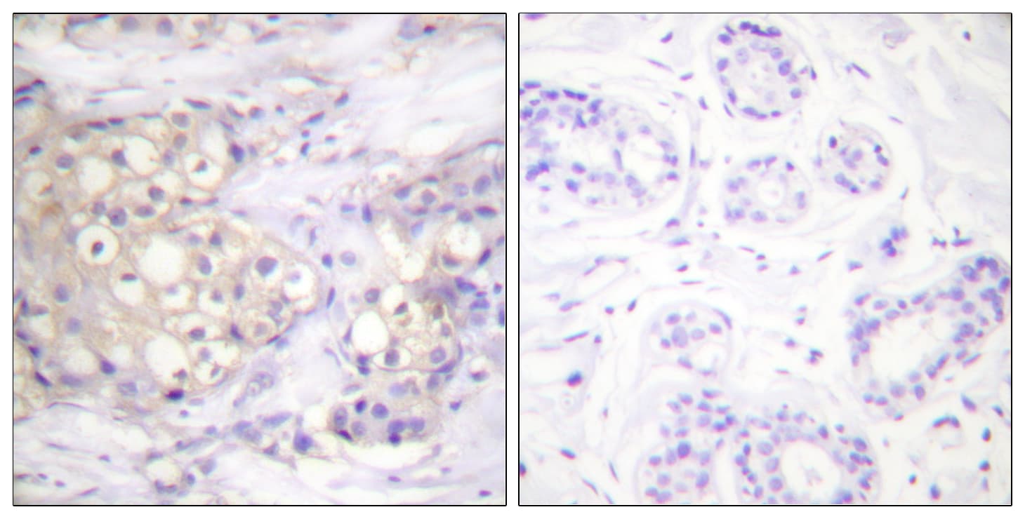PRKCA / PKC-Alpha Antibody (phospho-Thr638)