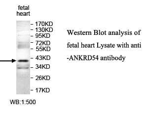Polyclonal Rabbit anti-Human ANKRD54 / LIAR Antibody (aa145-299, WB)