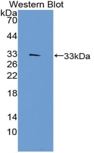 TP1 / TEP1 Antibody (aa2368-2627, Biotin)