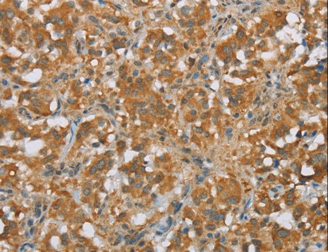FOXB1 Antibody