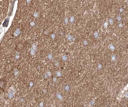 Polyclonal Rabbit anti-Human ABL1 / c-ABL Antibody (phospho-Tyr245, IF, WB)