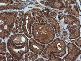 RTKN / Rhotekin Antibody (clone OTI2E9)