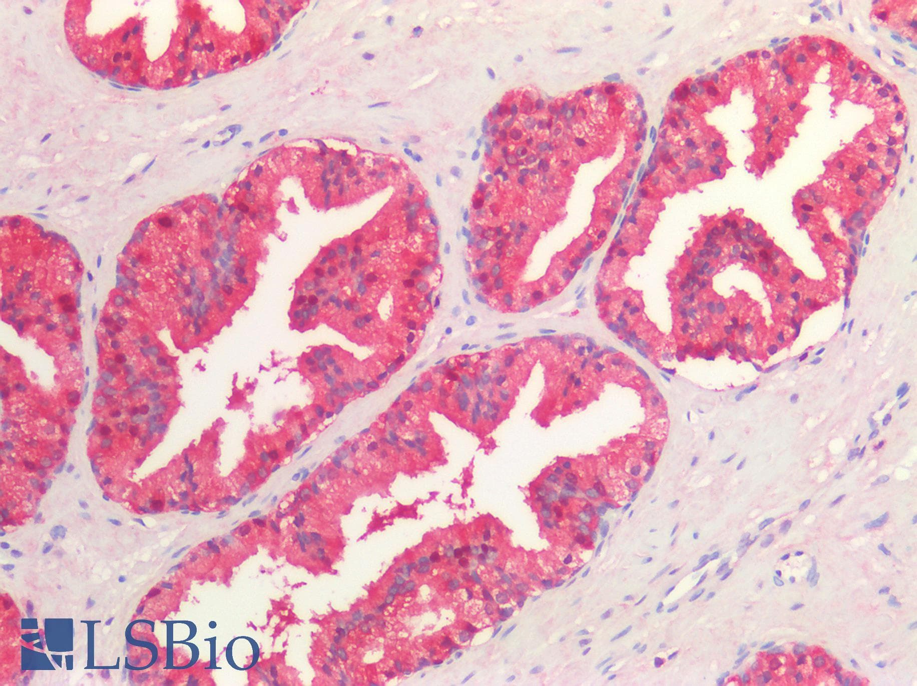 PathPlus™ IDH1 / IDH Antibody (clone C13)