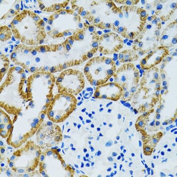 Polyclonal Rabbit anti-Human GDAP1 Antibody (IHC, WB)