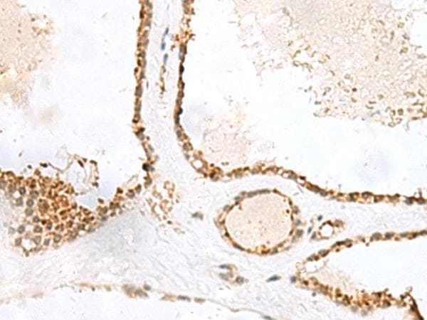 LPXN / Leupaxin Antibody